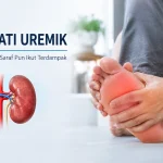 neuropati uremik